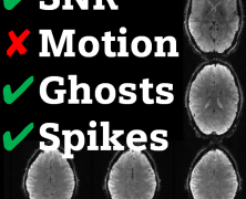 Inline fMRI QC