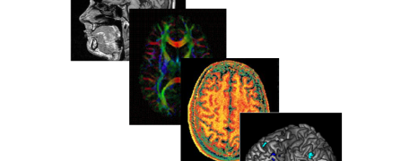 Multimodal Sturctural MRI Analysis