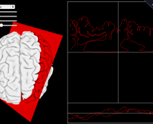 Aural Neuroanatomy