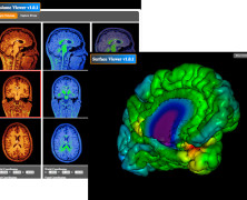 fMRI Analysis with CBRAIN